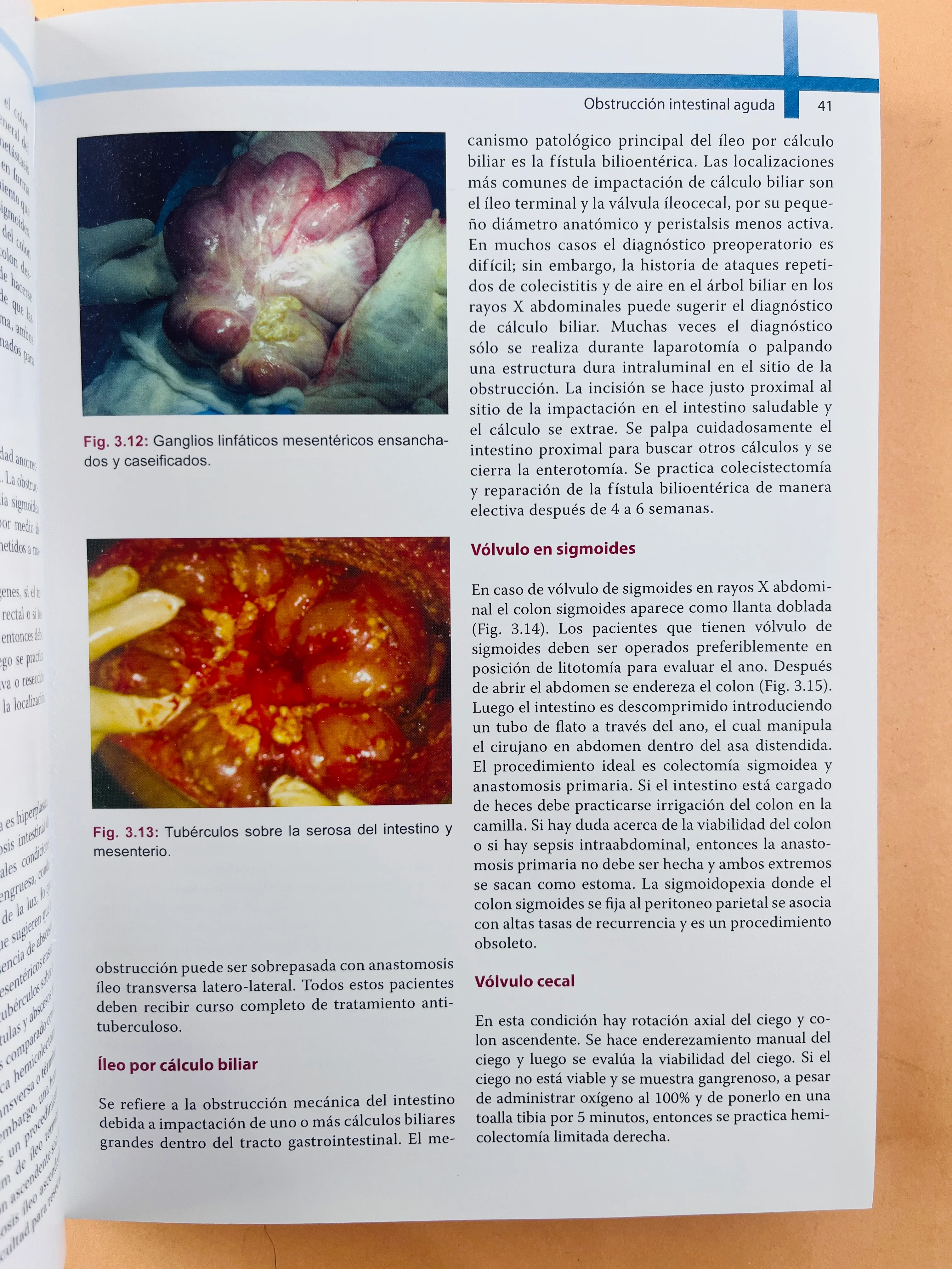 Abordaje en Emergencias Quirúrgicas - Image 4