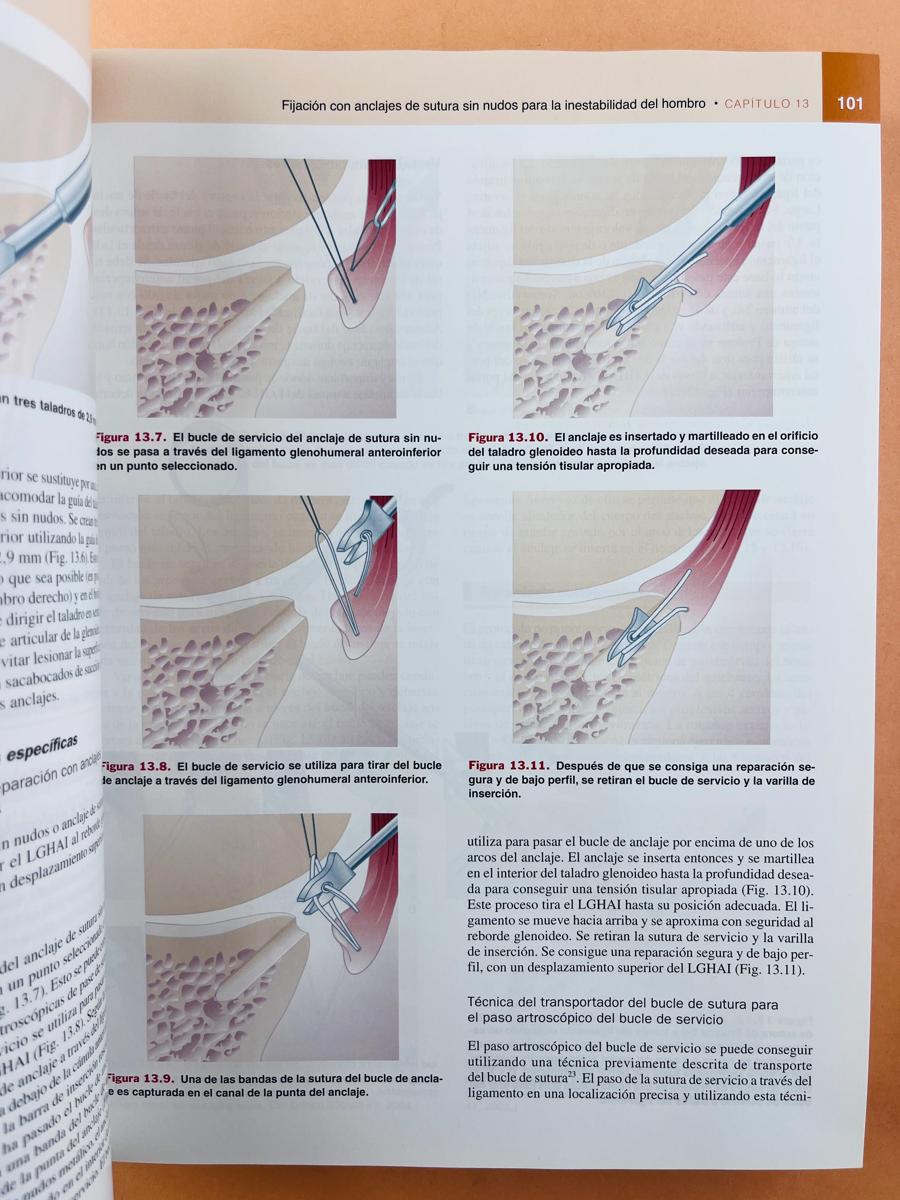 Artroscopia - Image 3