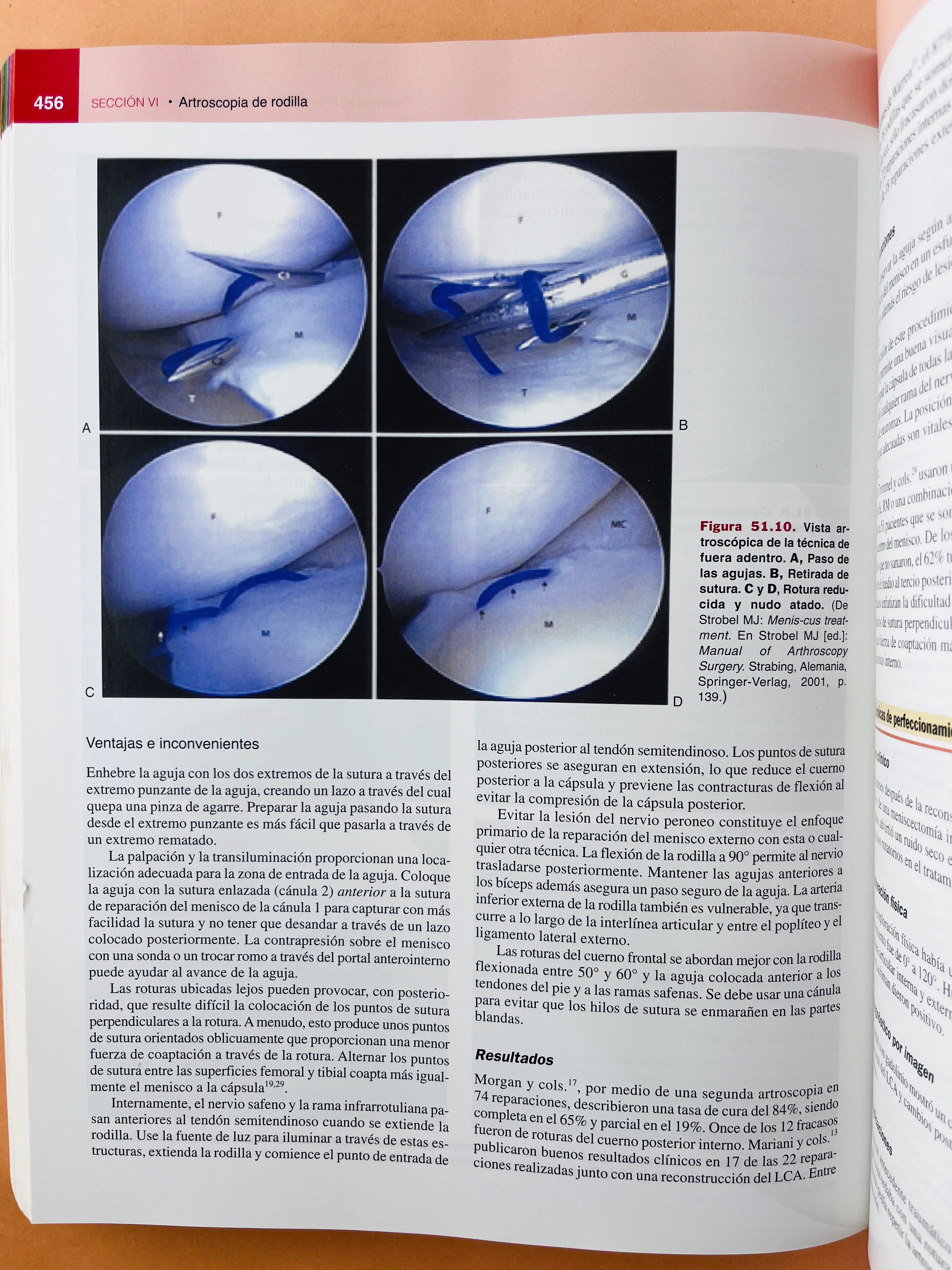 Artroscopia - Image 5