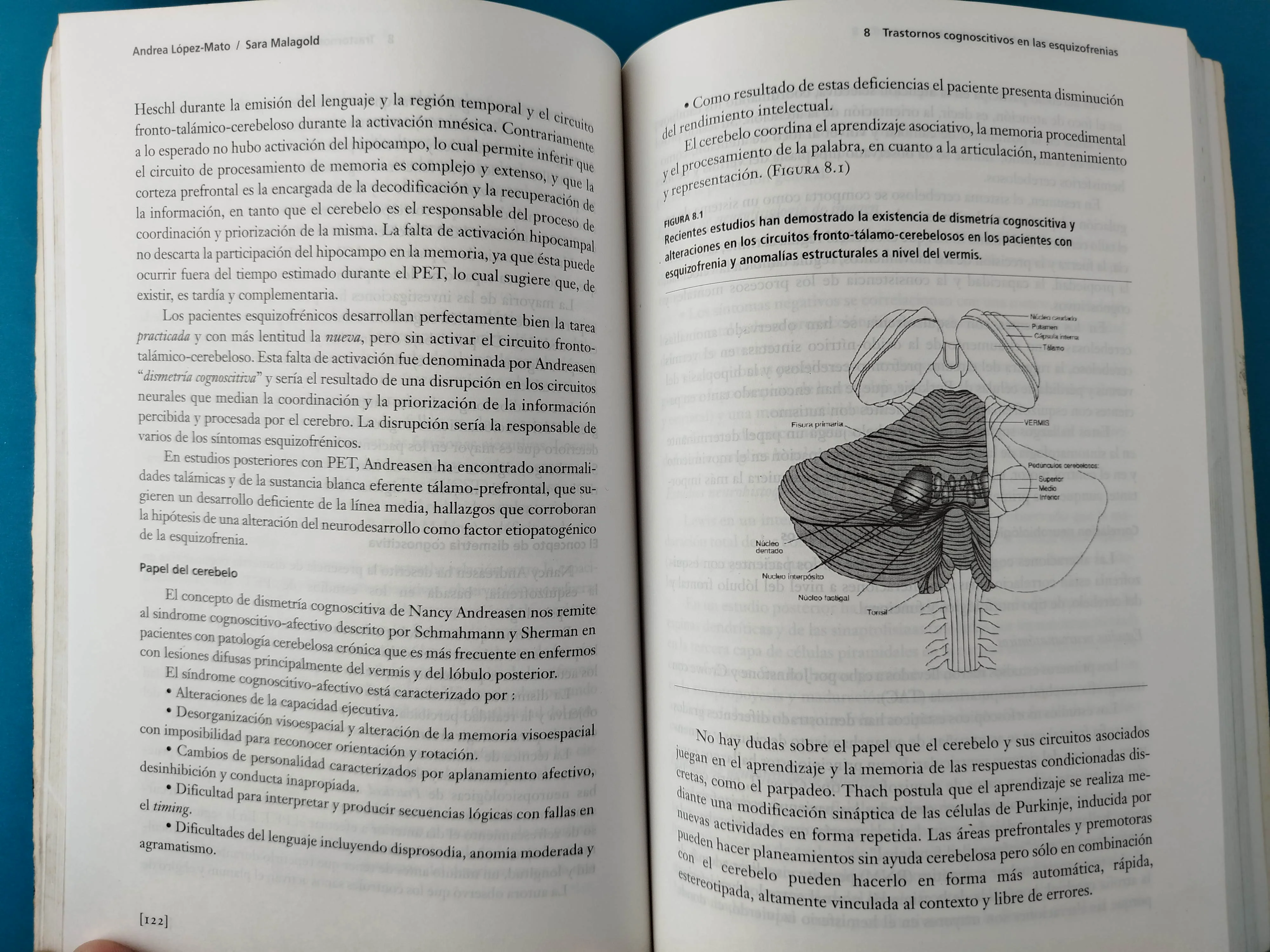 Aspectos Neurocognoscitivos De La Esquizofrenia - Image 3