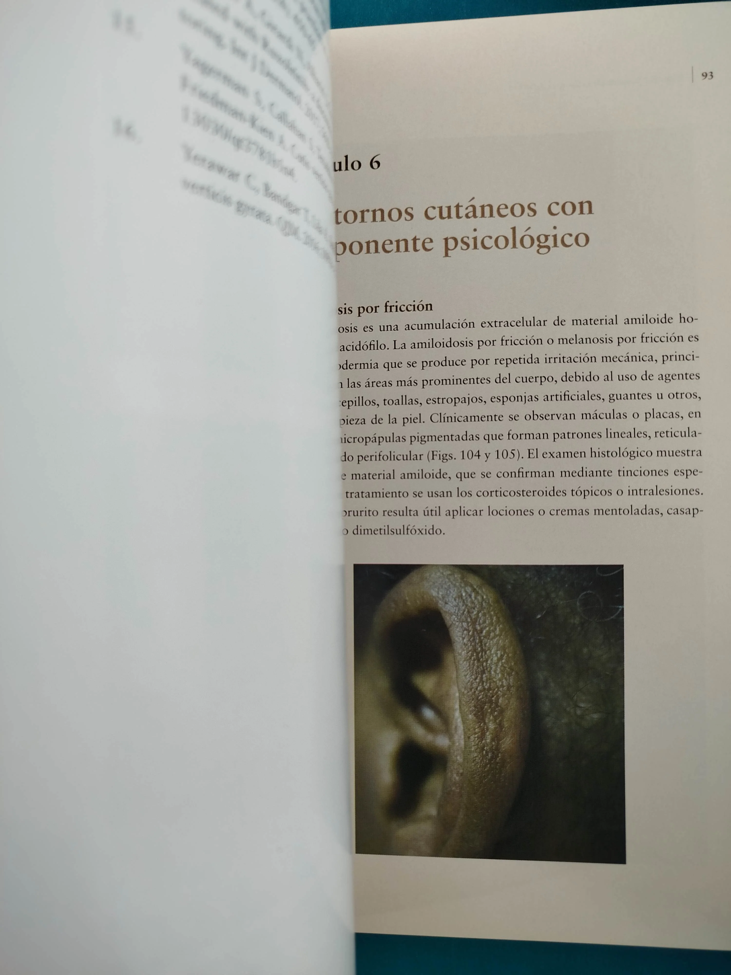 Atlas de dermatología clínica pieles oscuras - Image 4