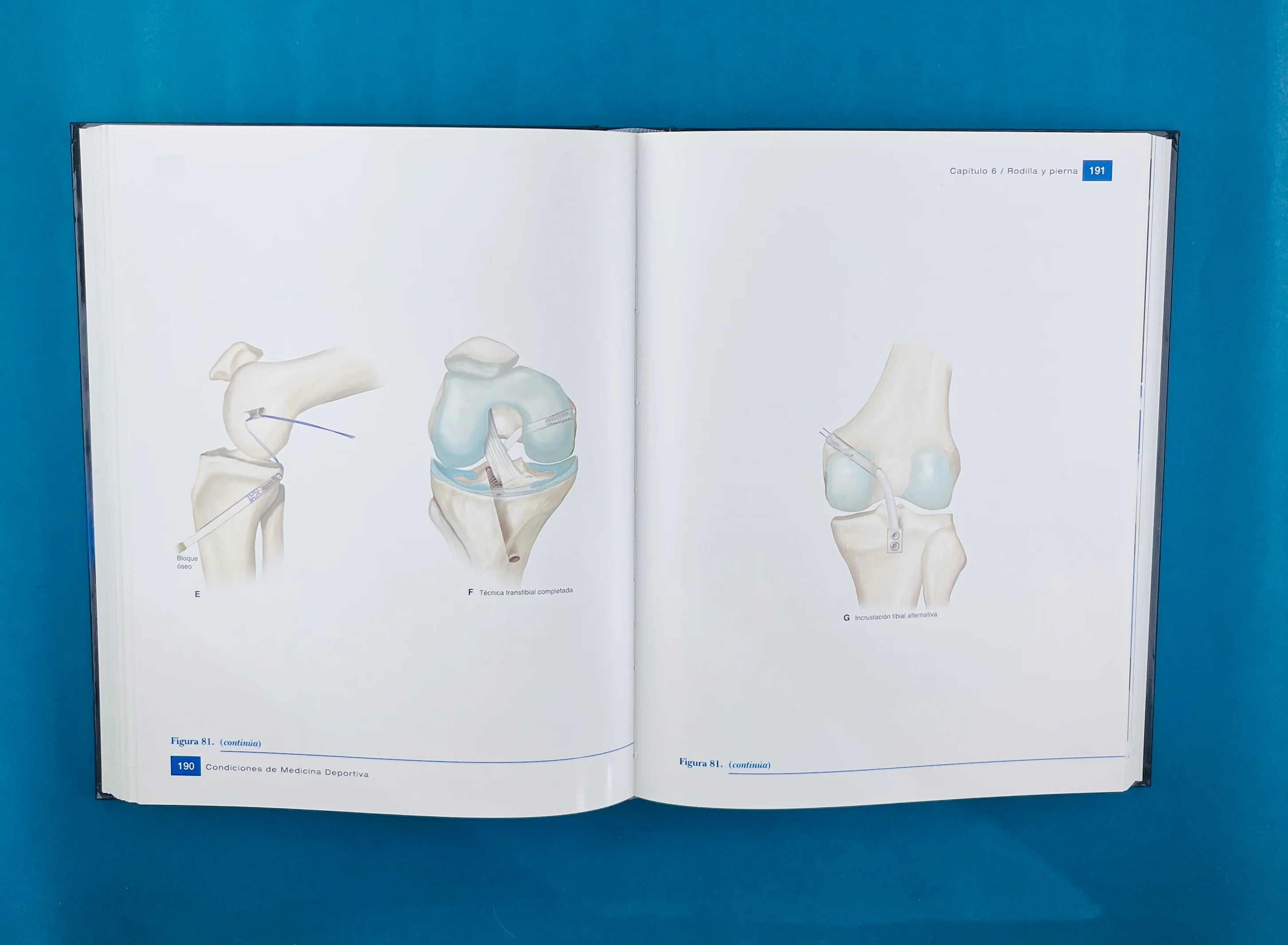 Condiciones de medicina deportiva reconocimiento, tratamiento planificación - Image 3