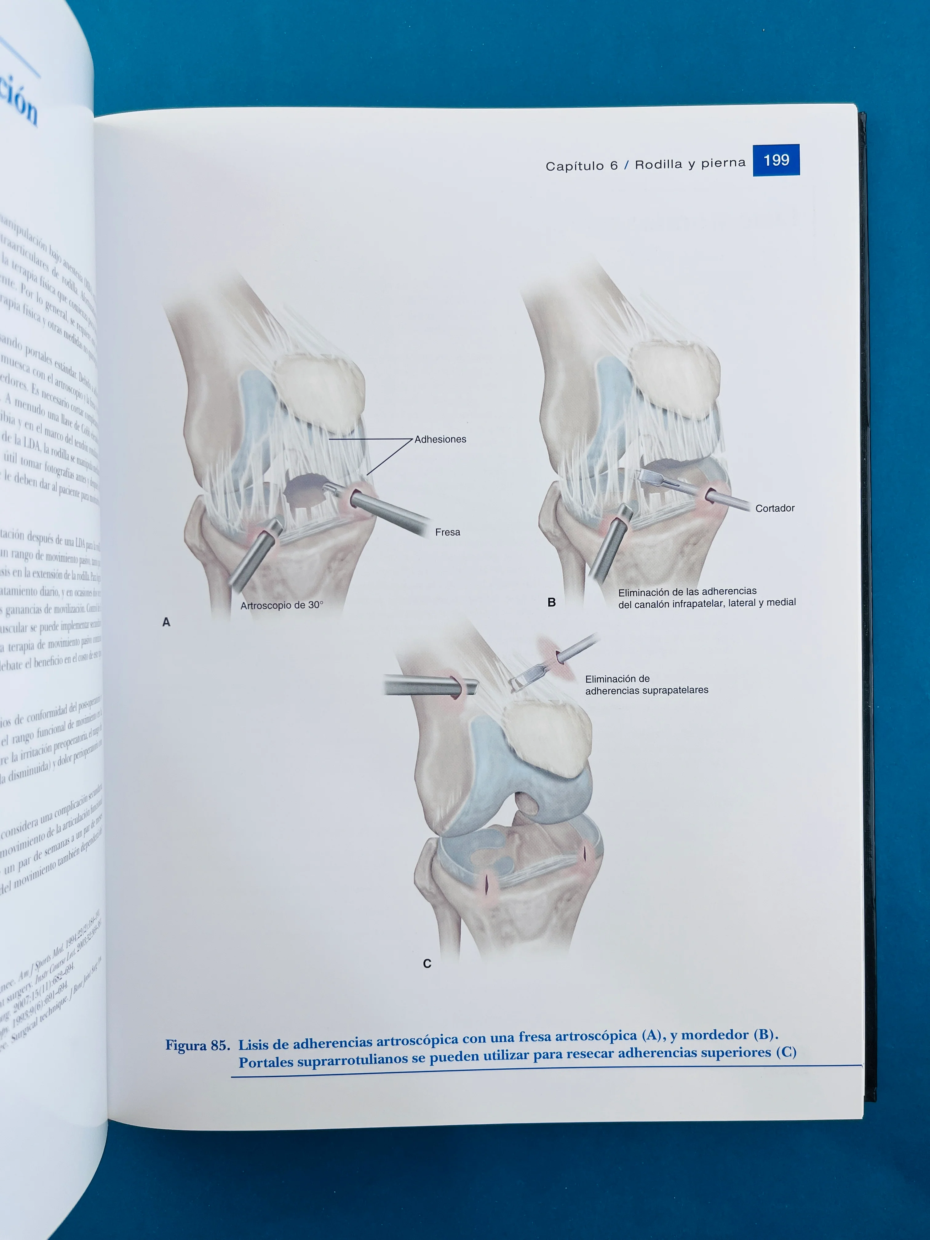 Condiciones de medicina deportiva reconocimiento, tratamiento planificación - Image 4