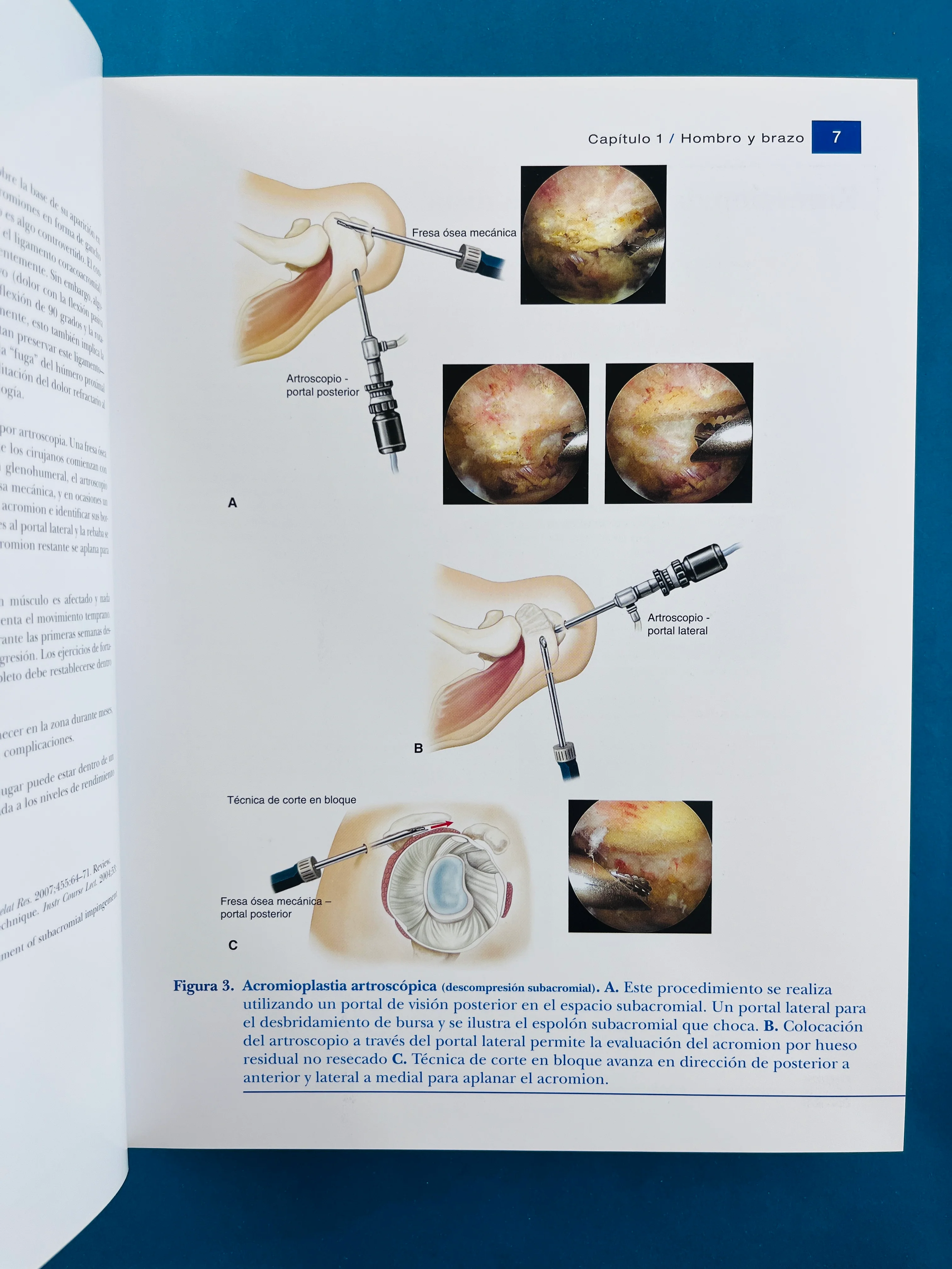 Condiciones de medicina deportiva reconocimiento, tratamiento planificación - Image 5