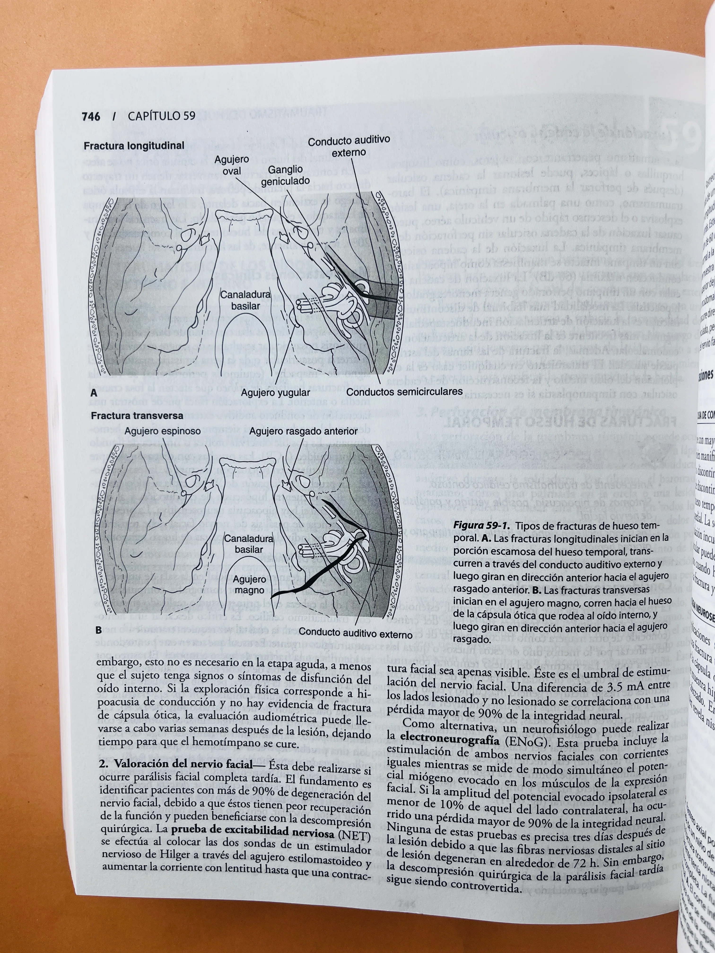 Diagnóstico y tratamiento en Otorrinolaringología cirugía de cabeza y cuello segunda edición - Image 5