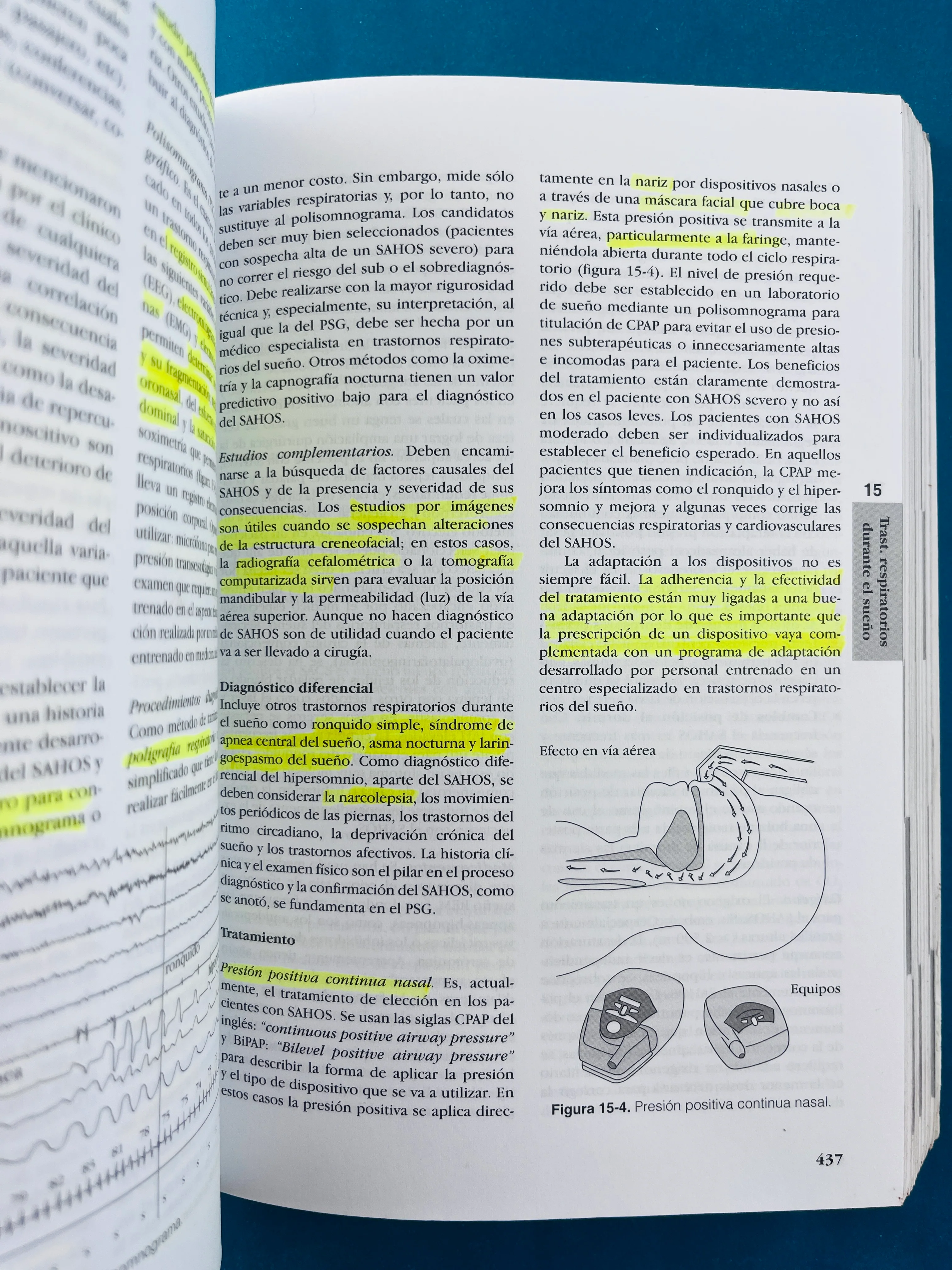 Fundamentos de medicina Neumologia sexta edición - Image 5