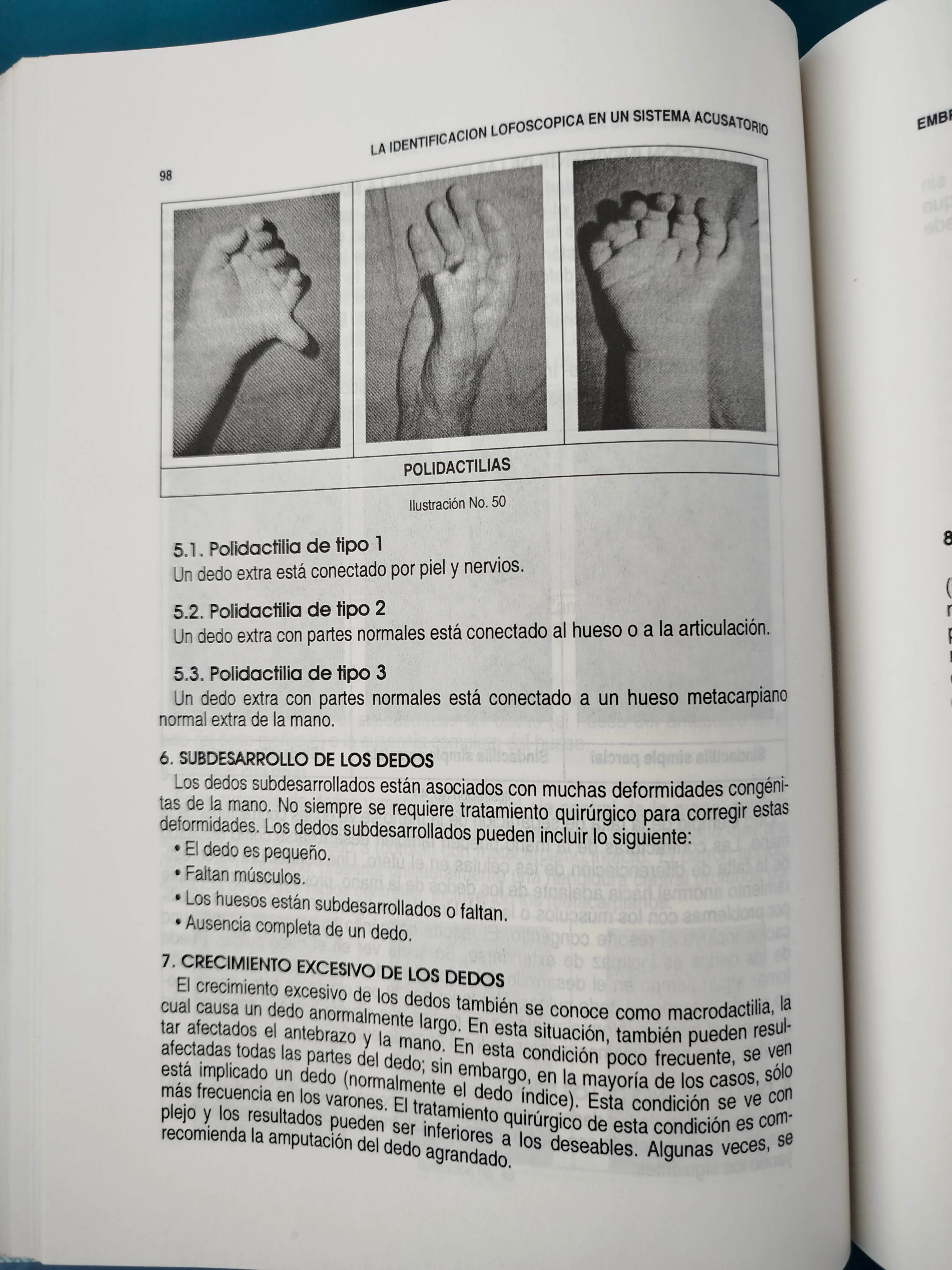 La identificación lofoscópica - Image 3