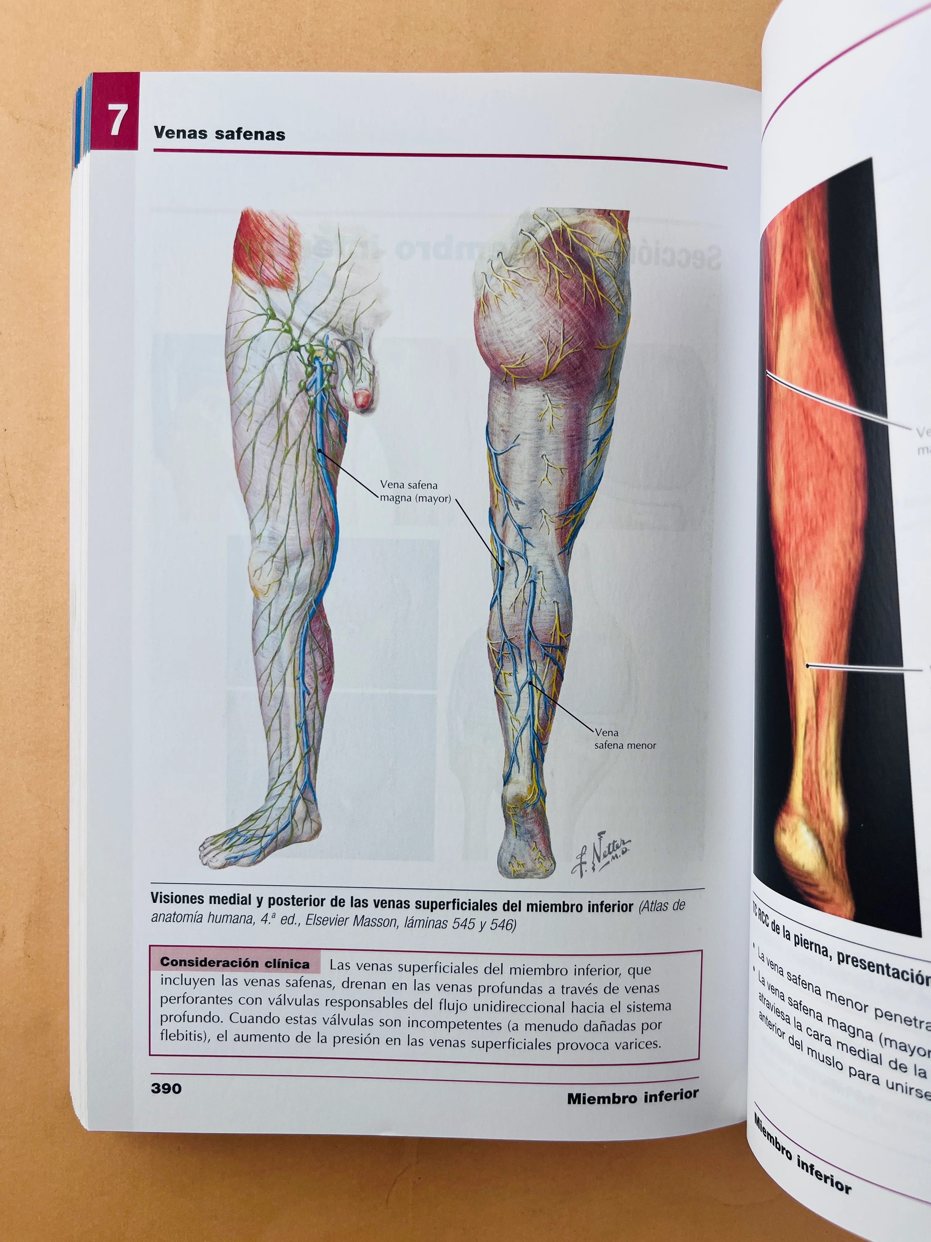 Netter anatomía radiológica esencial - Image 5