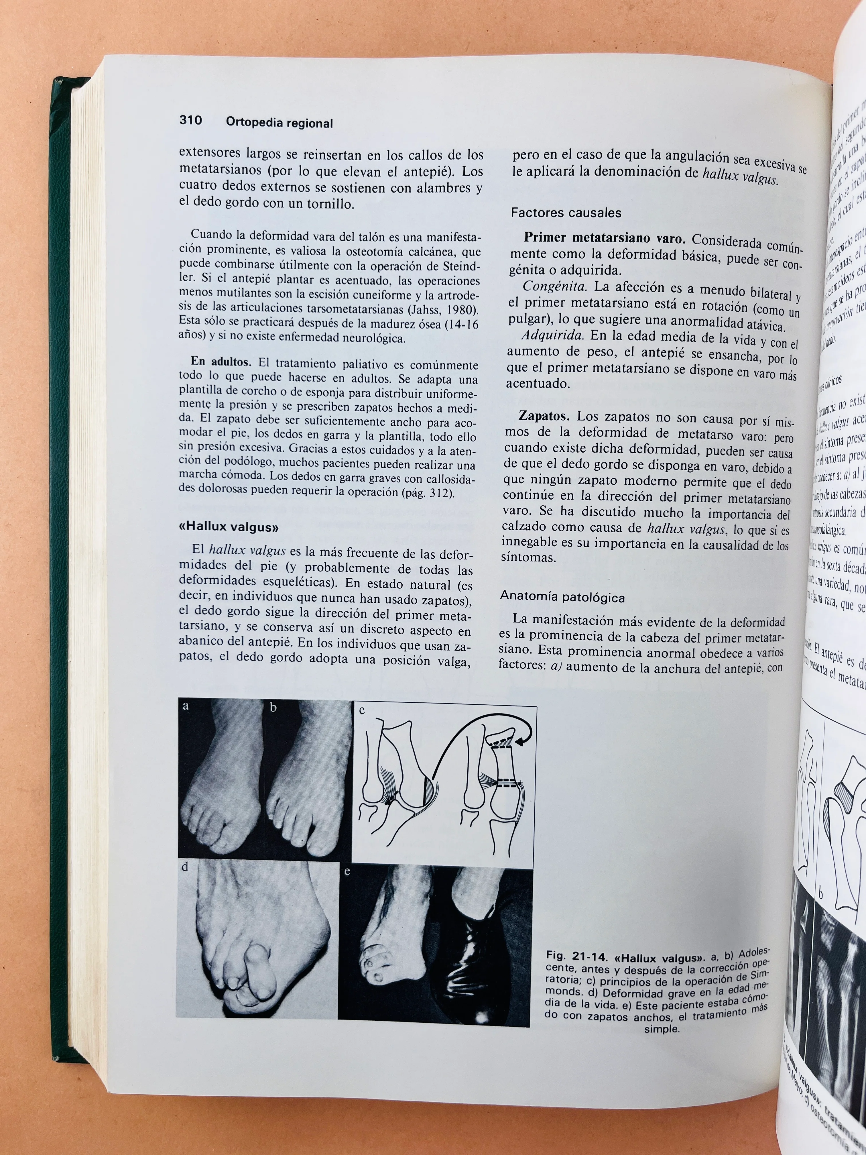 Ortopedia y tratamiento de fracturas segunda edición - Image 5