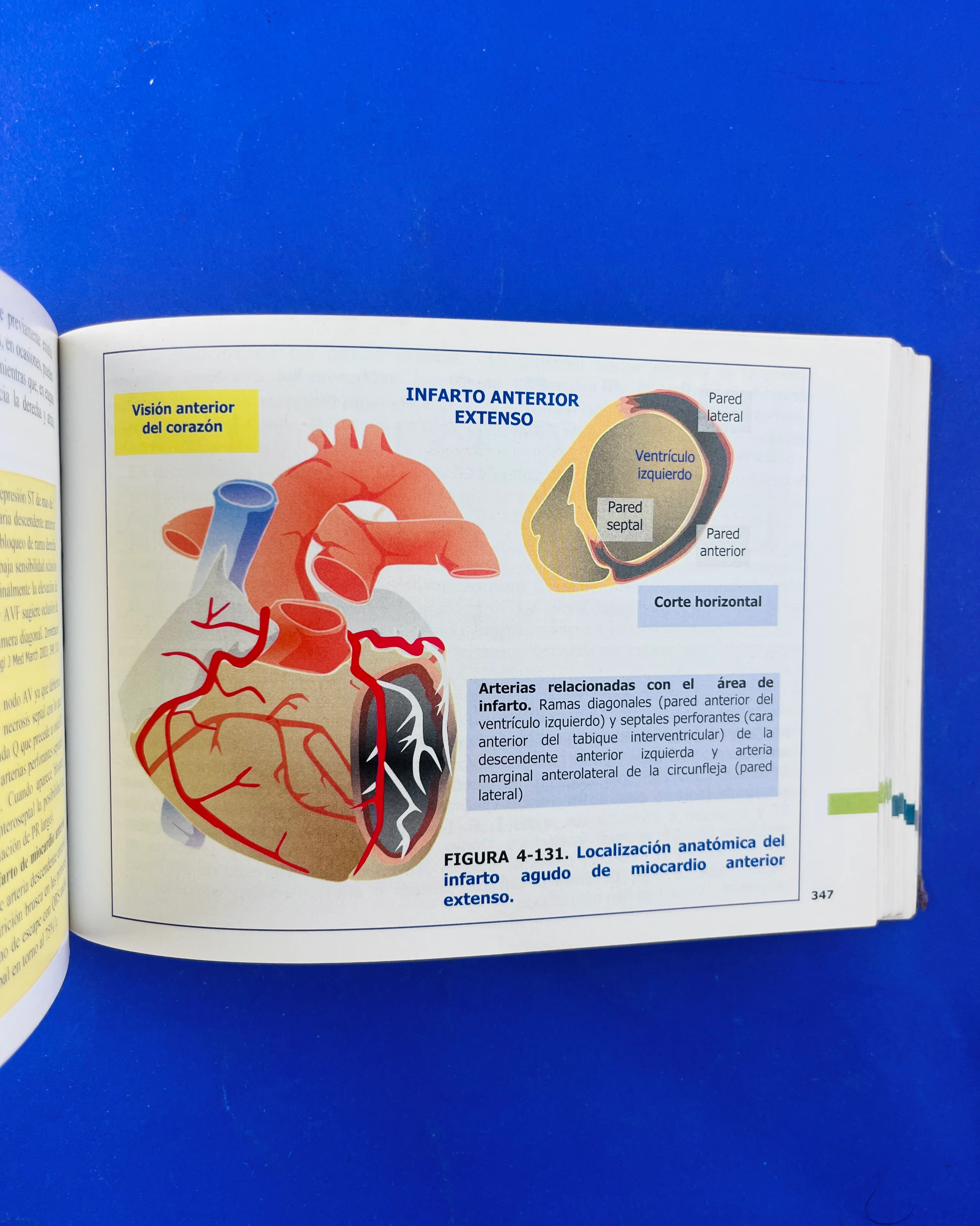Pautas en eléctrocardiograma ECG - Image 3