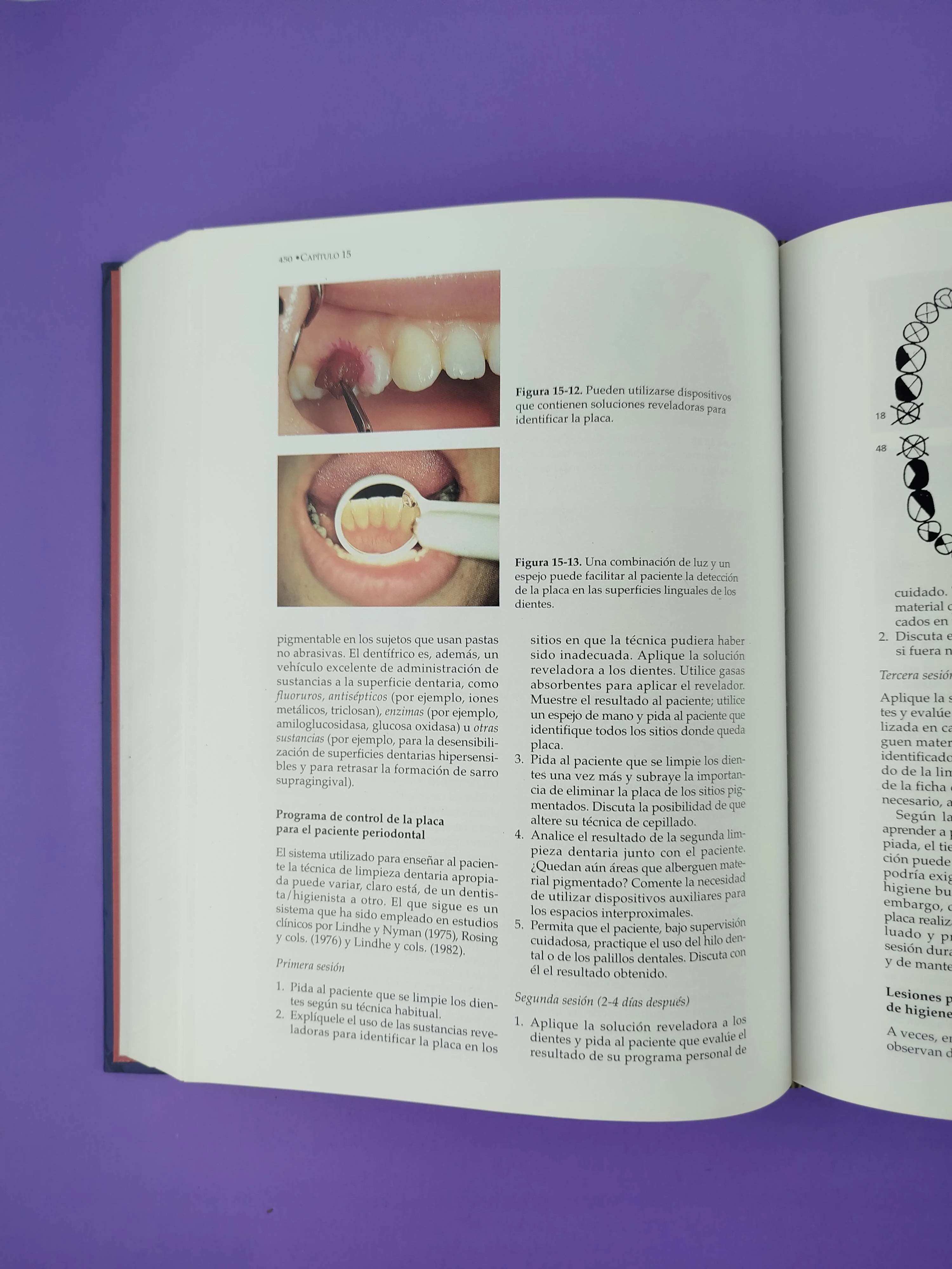 Periodontología clínica e implantología odontológica tercera edición - Image 3