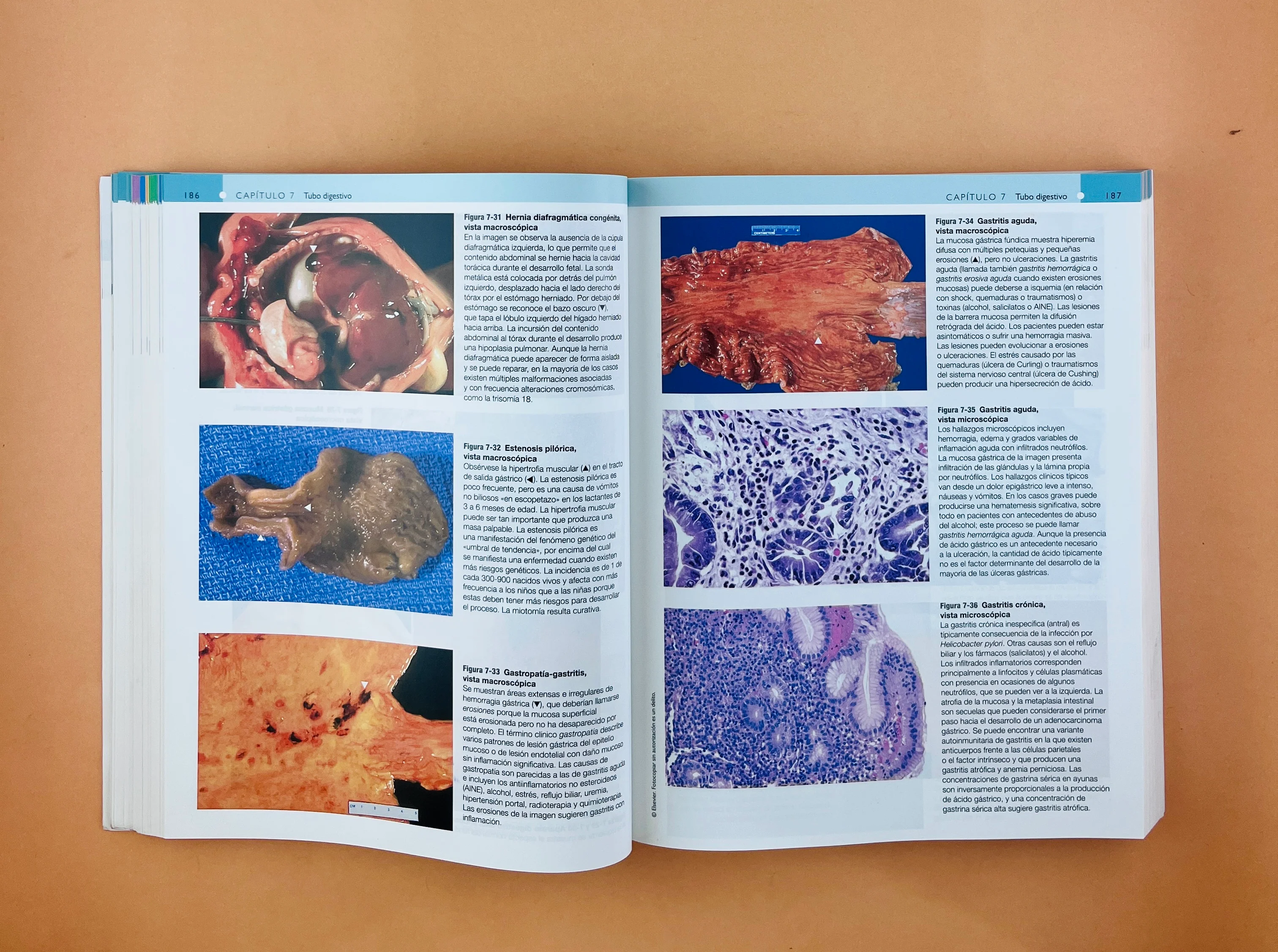 Robbins y Cotran Atlas de Anatomía Patológica tercera edición - Image 4