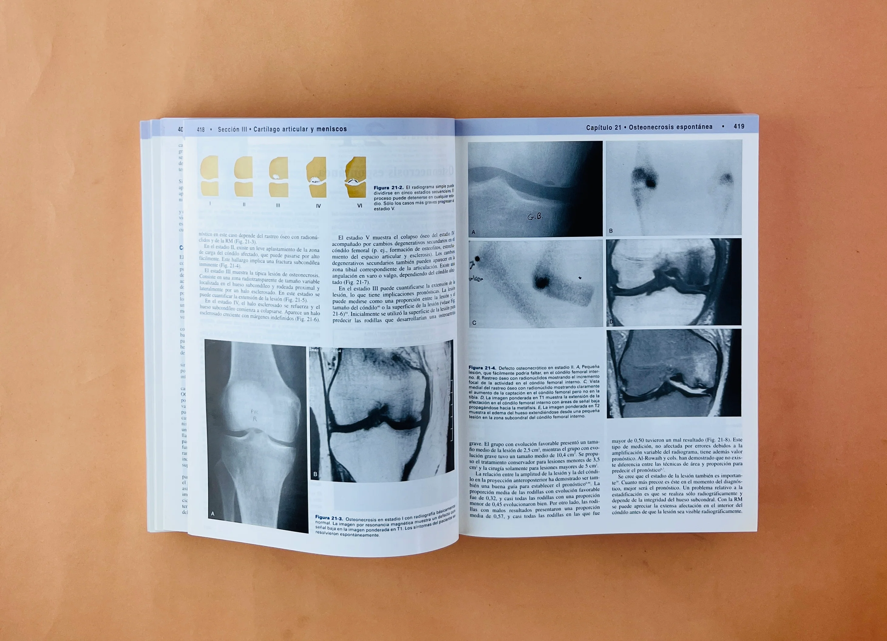 Rodilla 2 volúmenes - Image 3