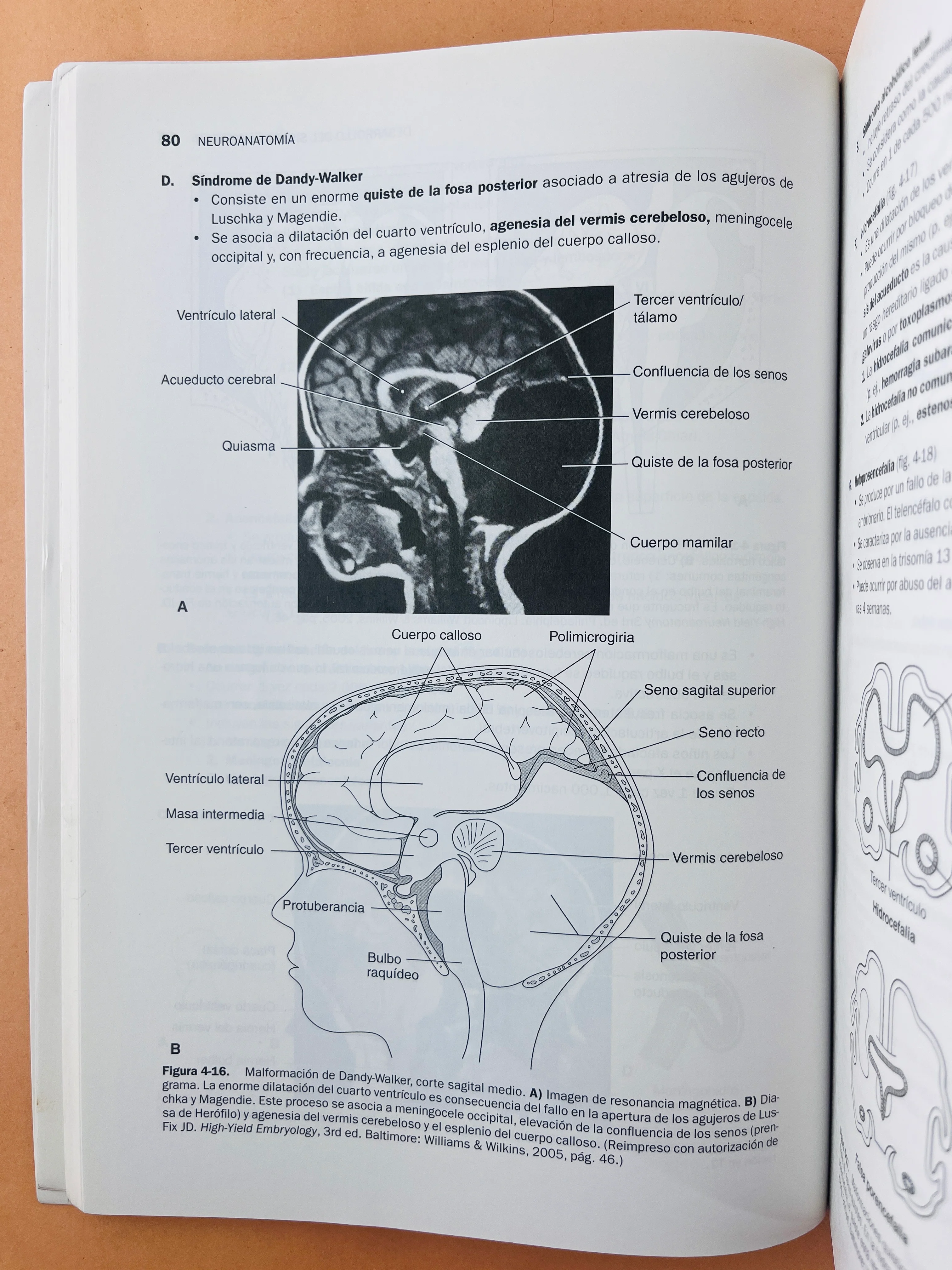 Temas clave neuroanatomía cuarta edición - Image 4