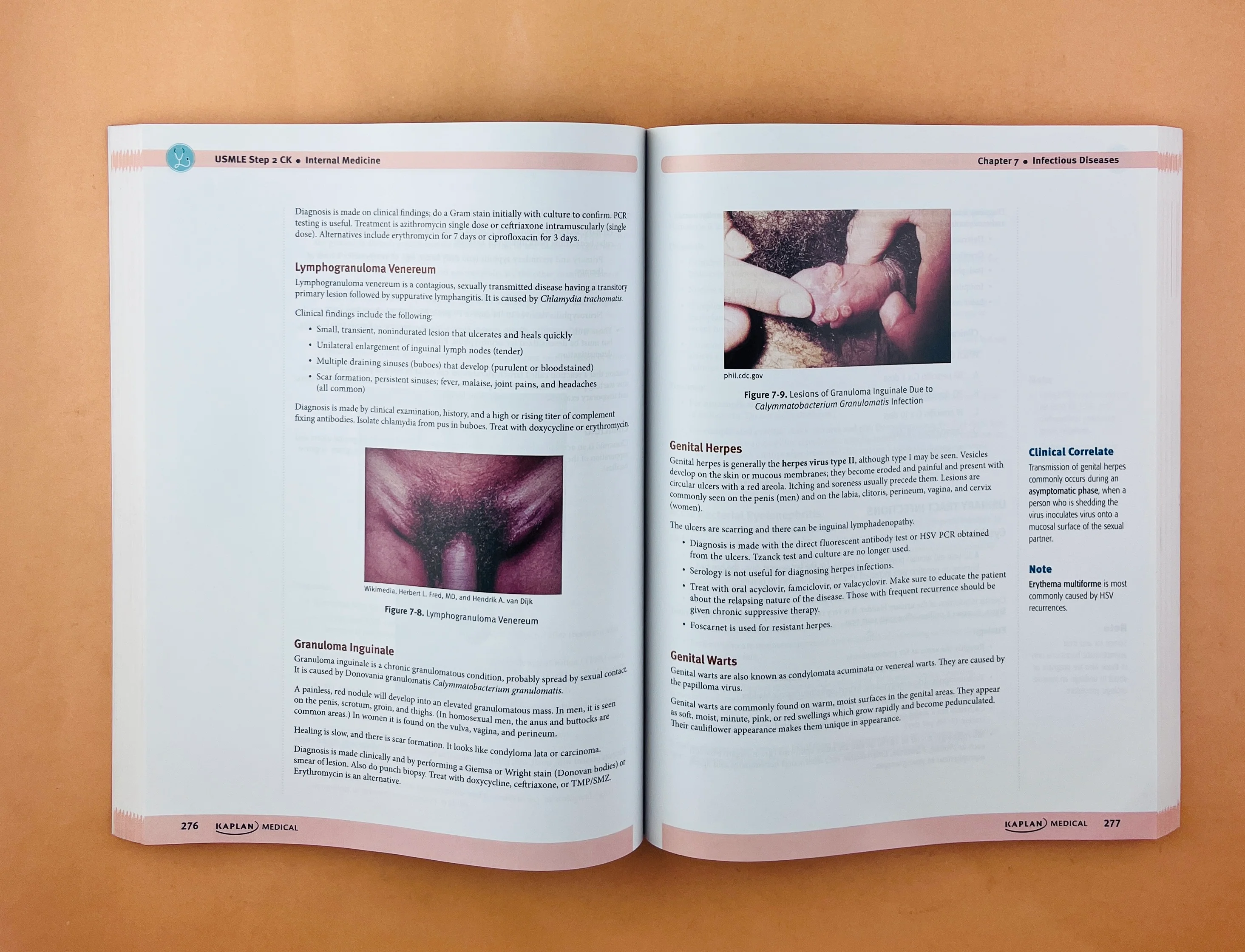 Usmle step 2 CK lectures notes 2021 5 volúmenes - Image 12
