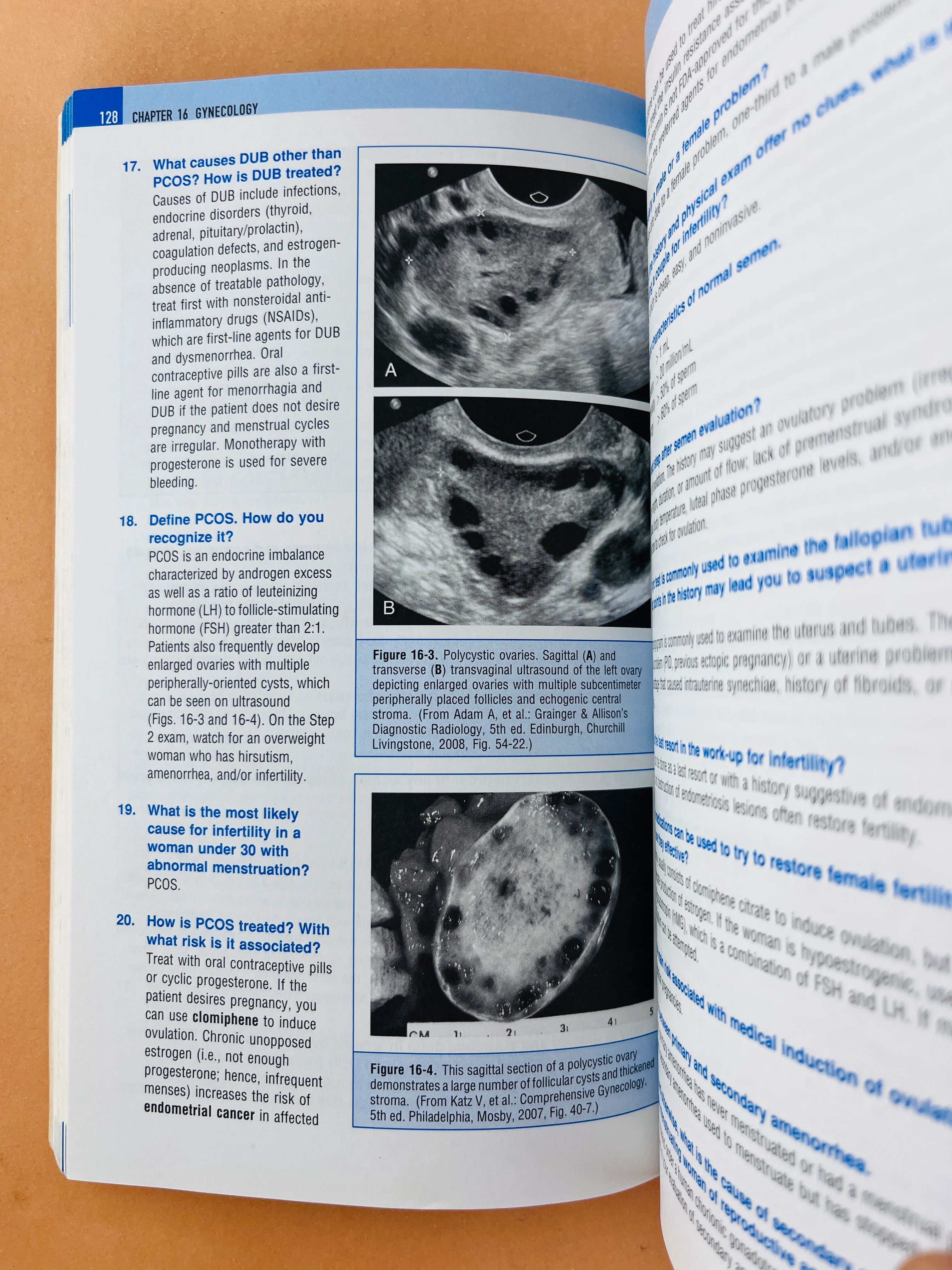Usmle step 2 secrets third edition - Image 4